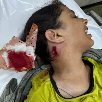 Ta 14-letnia dziewczynka została częściowo sparaliżowana.Zdjęcie: Mimi Syed
