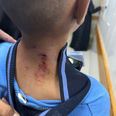 Według świadków, chłopiec (7 lub 8 lat) został postrzelony, gdy bawił się na dworze.Zdjęcie: Mimi Syed
